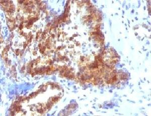 Anti-PSA (Prostate Specific Antigen), clone KLK3/1248