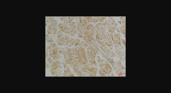Anti-Desmin, monoclonal