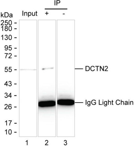 Anti-DCTN2