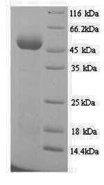 Elongation factor Tu (tuf1), Acinetobacter baumannii, recombinant