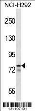 Anti-MLXIPL, CT (MLXIPL, BHLHD14, MIO, WBSCR14, Carbohydrate-responsive element-binding protein, Cla