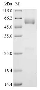 Metal cation symporter ZIP14 (SLC39A14), partial, recombinant human