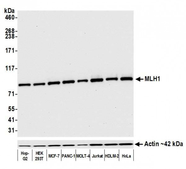 Anti-MLH1 Recombinant Monoclonal