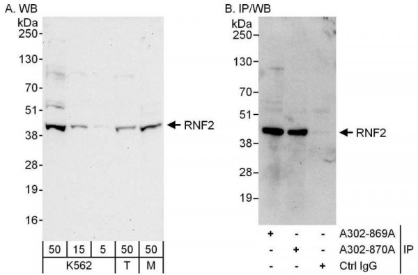 Anti-RNF2