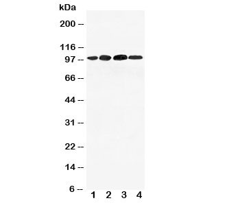 Anti-Mineralocorticoid Receptor