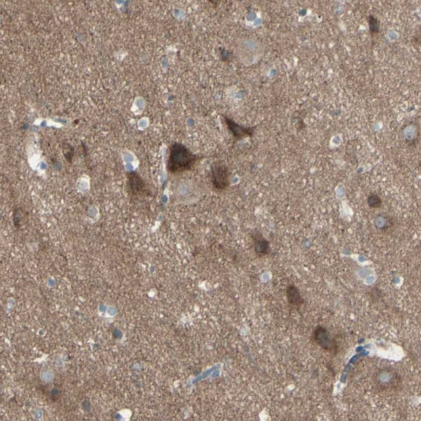 Anti-PCDHGA2