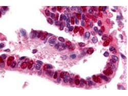 Anti-Ubiquitin E1 Conjugating Enzyme