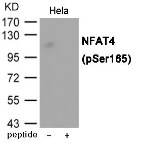 Anti-Phospho-NFATC3 (Ser165)