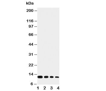 Anti-Eotaxin