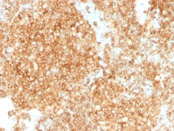 Anti-CD45 / LCA (Leucocyte Marker) Monoclonal Antibody (Clone: PTPRC/1147 + PTPRC/1460)