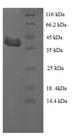 Leucine-rich repeat flightless-interacting protein 1 (LRRFIP1), partial, human, recombinant