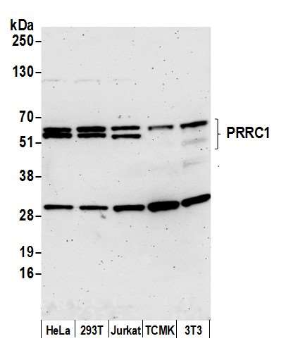 Anti-PRRC1