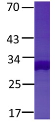 NFE2L2 Protein E79Q mutant