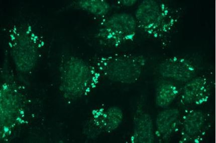 Anti-Nephrin, clone Y17-R