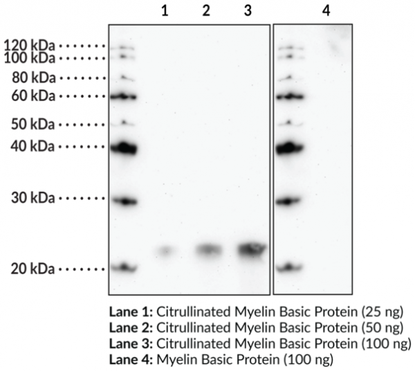Anti-citrulinated-Citrullinated Myelin Basic Protein