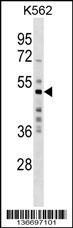 Anti-MKRN2, NT (MKRN2, RNF62, Probable E3 ubiquitin-protein ligase makorin-2, RING finger protein 62