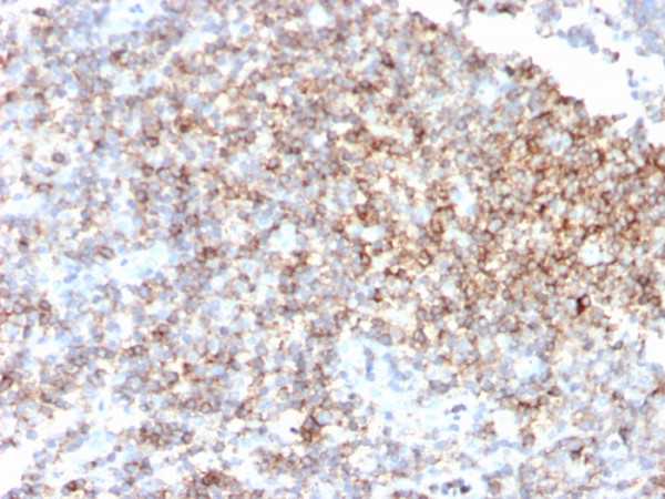Anti-CD48 (Pan Leukocyte Marker), clone CD48/4785