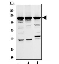 Anti-EIF3B