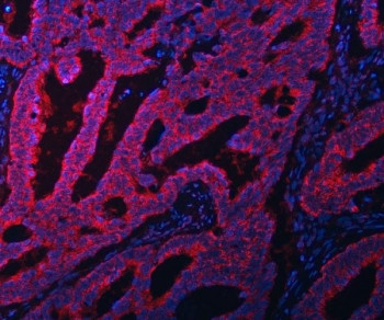 Anti-EIF3A / Eukaryotic translation initiation factor 3 subunit A