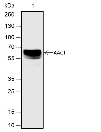 Anti-Recombinant AACT, clone A629
