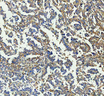 Anti-GBP1 / Guanylate-binding protein 1