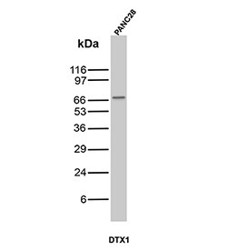Anti-ABCC3 / ATP-binding cassette subfamily C member 3, clone rDTX1