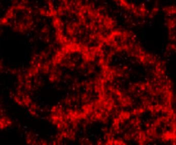 Anti-CD81, clone M38