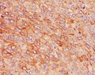 Anti-CD104 / Integrin beta 4