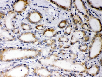 Anti-EBAG9 / RCAS1