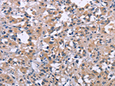 Anti-DUSP1