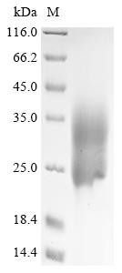Fusion glycoprotein F0 (F), partial, human metapneumovirus, recombinant