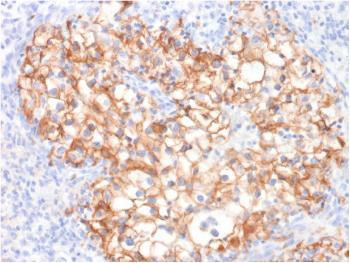Anti-Ksp-Cadherin / CDH16 (Renal Cell Marker) Monoclona Antibody (Clone: CDH16/2125)
