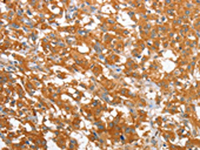 Anti-WNT3A