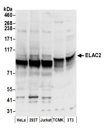Anti-ELAC2
