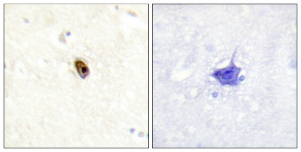 Anti-Phospho-AURKC (Thr236/202)