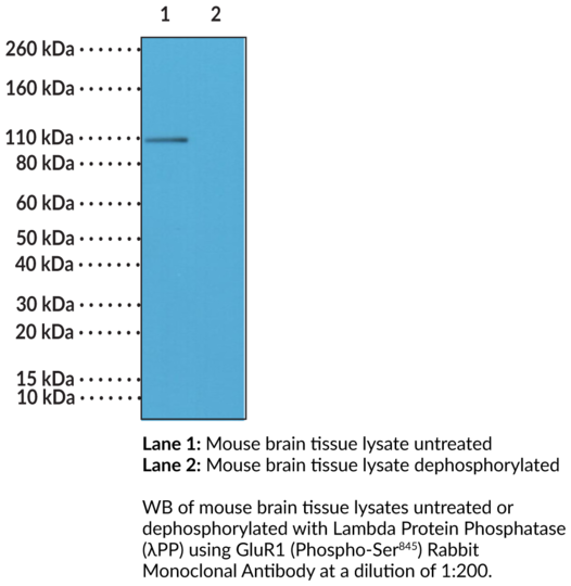 Anti-GluR1 (Phospho-Ser845) Rabbit Monoclonal Antibody (Clone RM296)