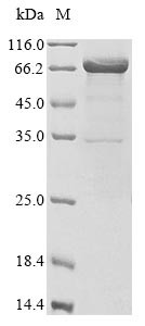 Neutrophil elastase (ELANE), Biotinylated, human, recombinant
