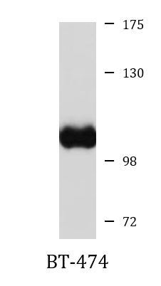 Anti-PEX6