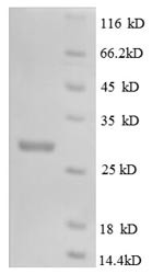 Macrophage colony-stimulating factor 1 (Csf1), partial, mouse, recombinant