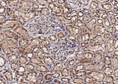 Anti-ACOX1/AOX Monoclonal Recombinant Antibody