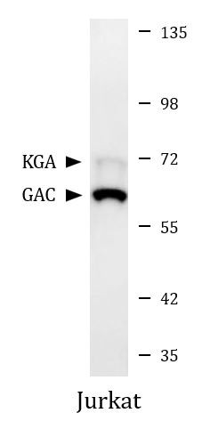 Anti-Glutaminase