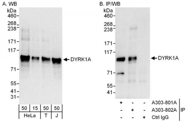 Anti-DYRK1A