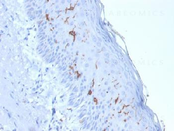 Anti-CD1a / HTA1 (Mature Langerhans Cells Marker) Recombinant Mouse Monoclonal Antibody (clone:rC1A/