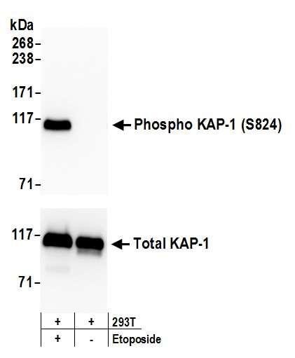 Anti-phospho-KAP-1 (Ser824) Recombinant Monoclonal