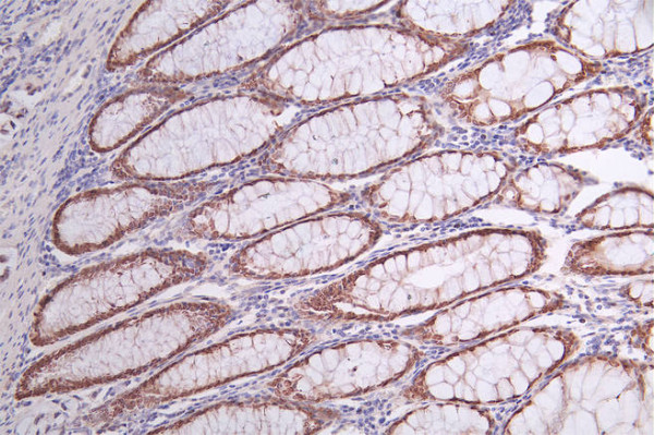 Anti-SATB2 Recombinant Monoclonal, clone 3B12