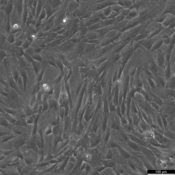 Wilms1 Cells