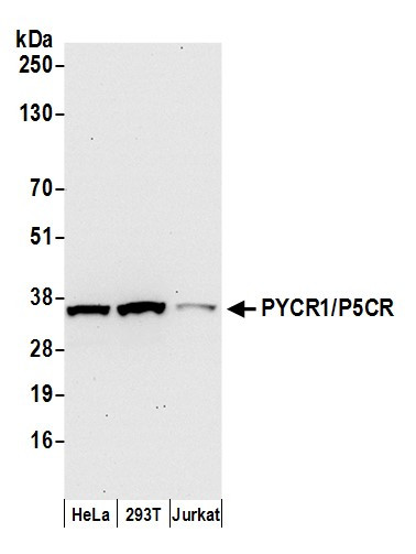 Anti-PYCR1/P5CR