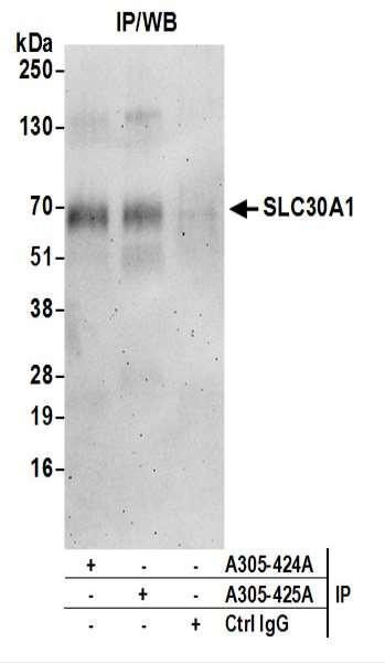 Anti-SLC30A1/ZNT1