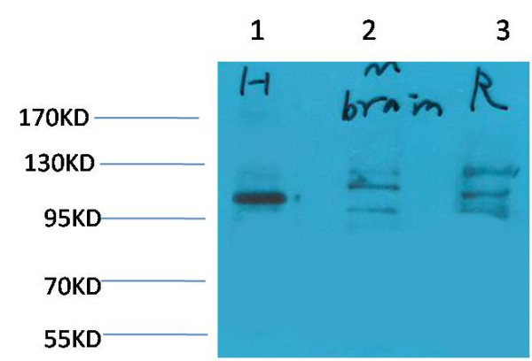 Anti-Glutamate Receptor 1