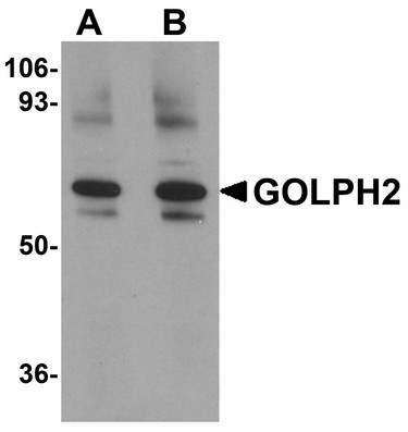Anti-GOLPH2